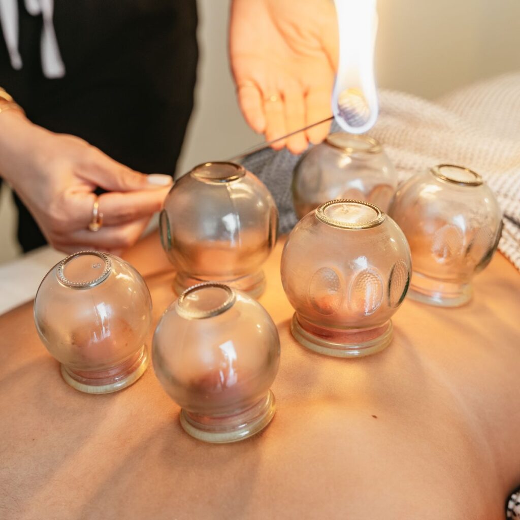 cupping therapy