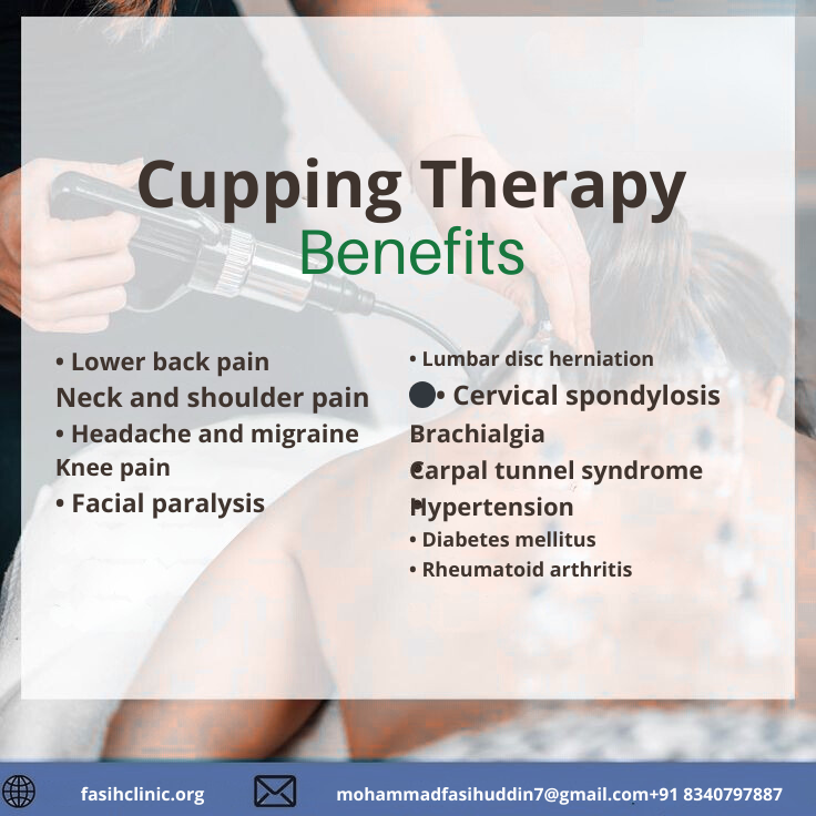 cupping therapy